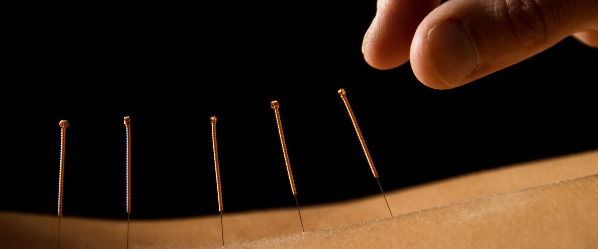Acupuncteur à Toulouse (31), cabinet d'acupuncture | Cabinet d ...